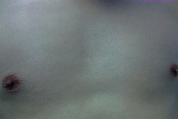 Gallery image 1