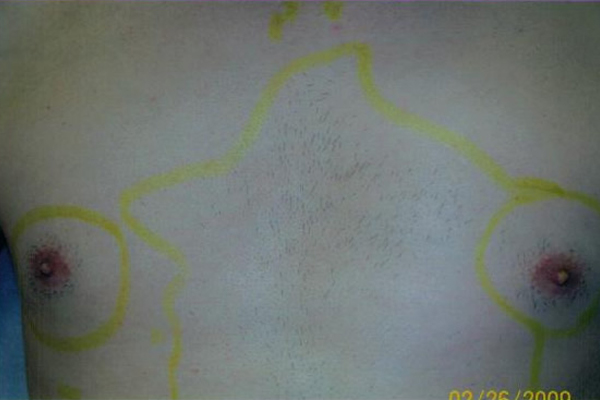 Gallery image 0